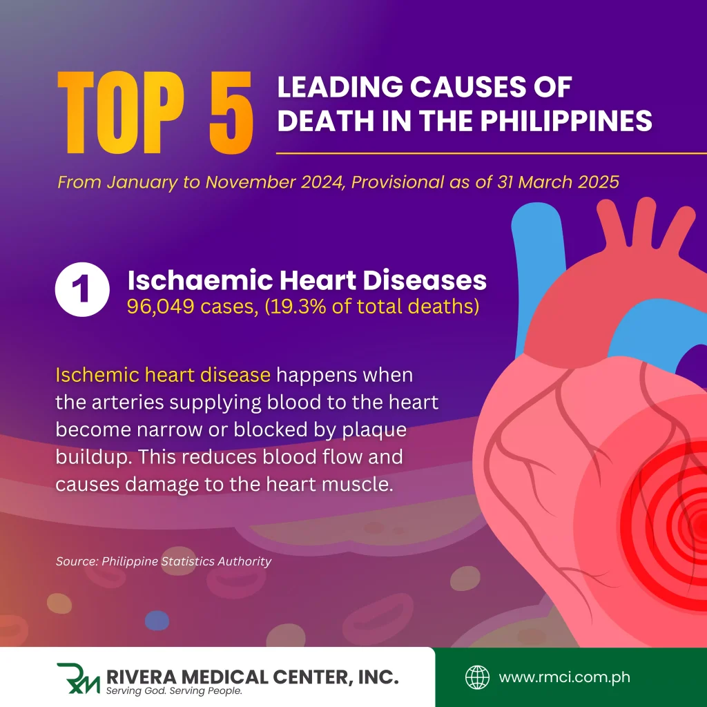 ischemic-heart-disease-leading-cause-of-death-in-the-Philippines