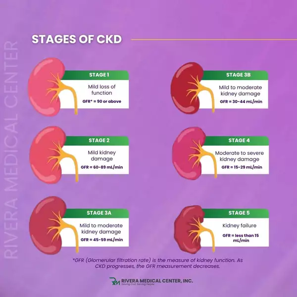 what-are-the-stages-of-chronic-kidney-disease
