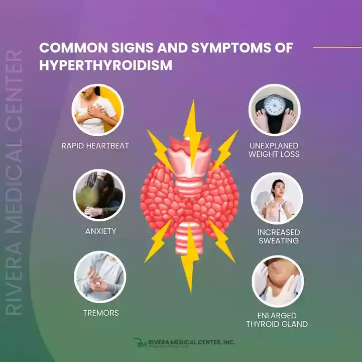 hyperthyroidism-in-davao