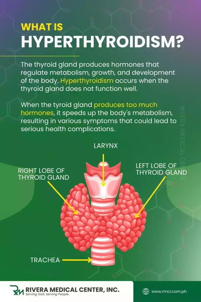 hyperthyroidism-in-the-philippines