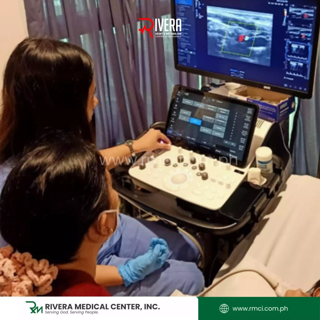 carotid-doppler-ultrasound