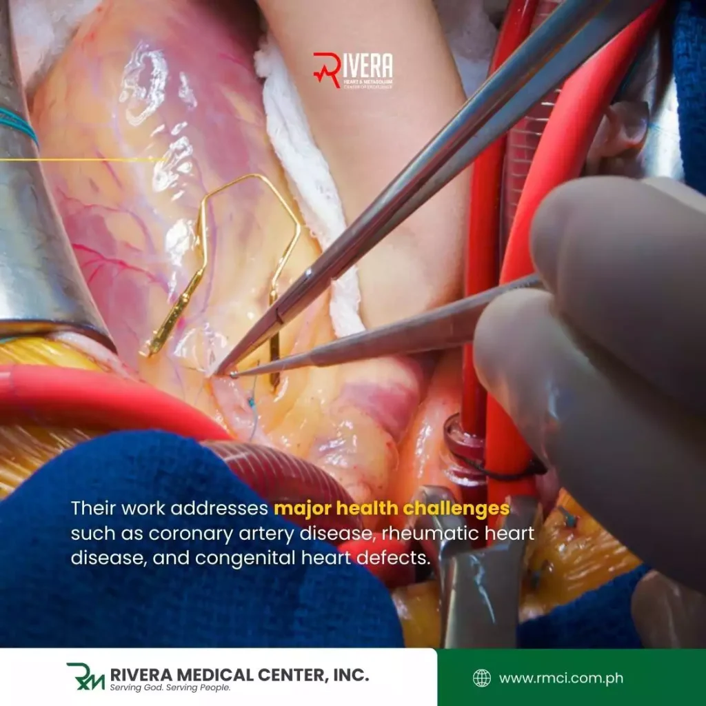 cardiac-surgeon-davao