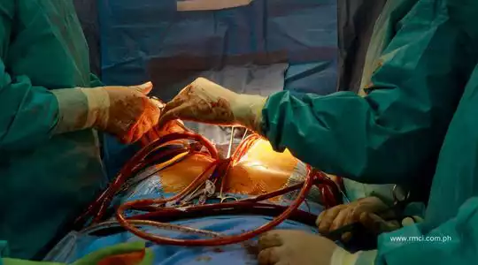 cardiac-surgeon-davao-del-norte