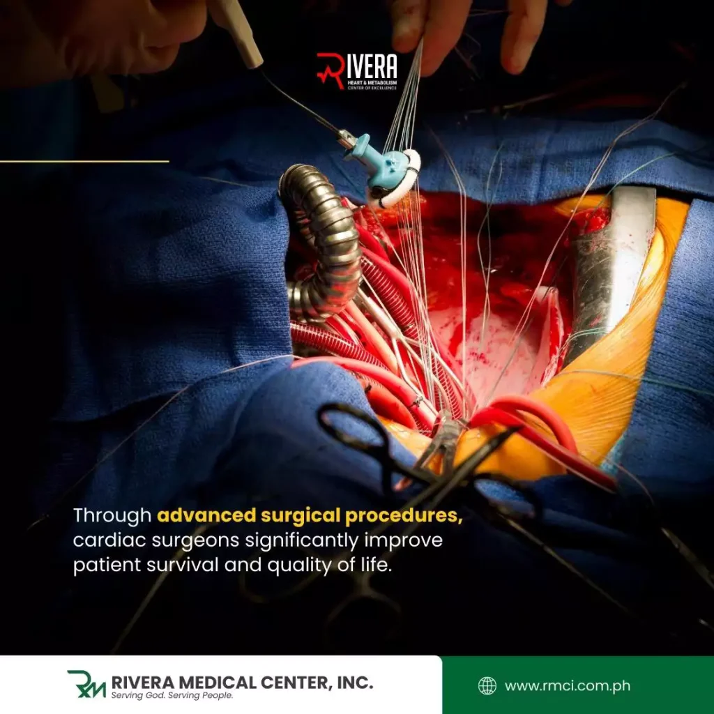 cardiac-surgeon-davao-del-norte