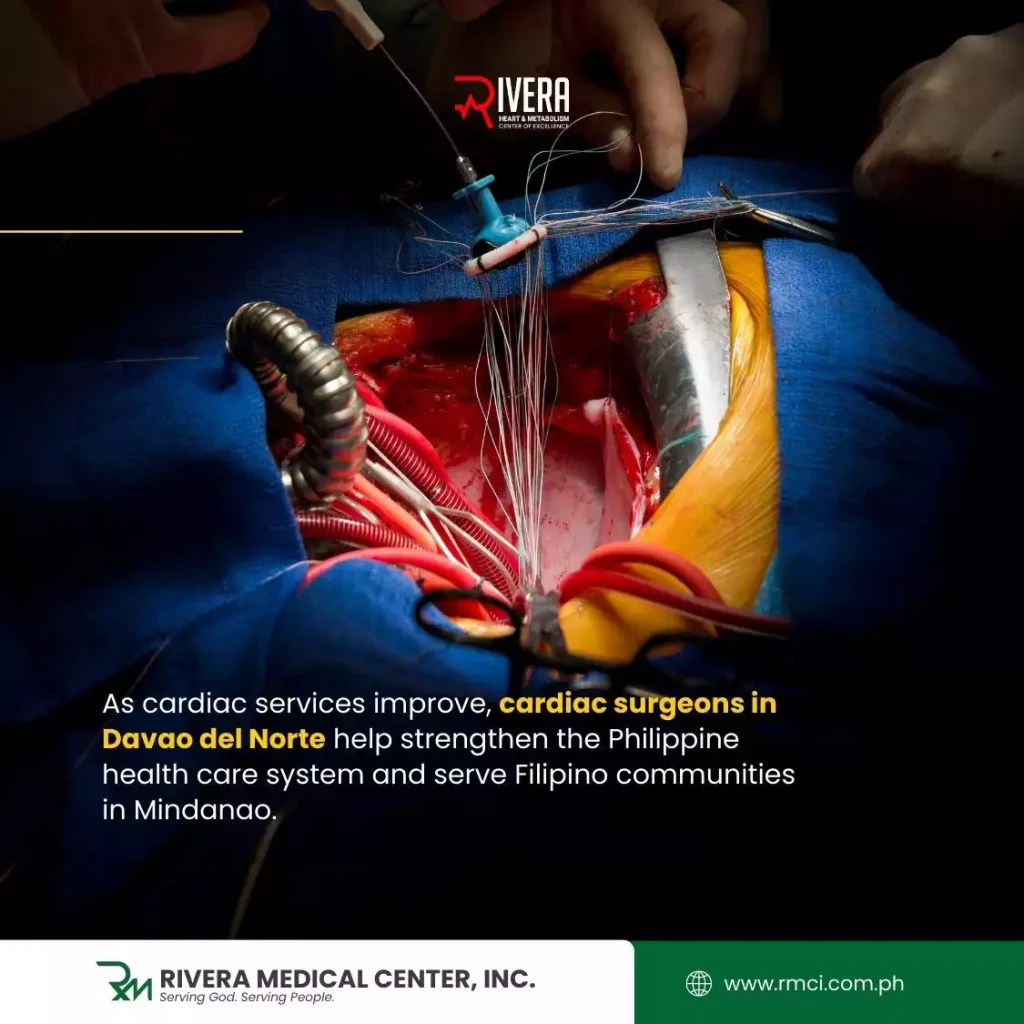 cardiac-surgeon-davao-del-norte-tagum