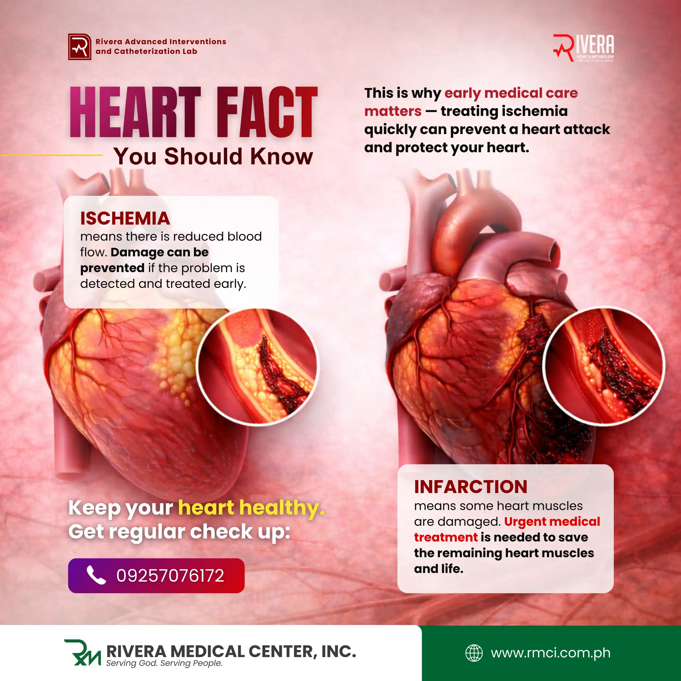 heart-attack-infarction